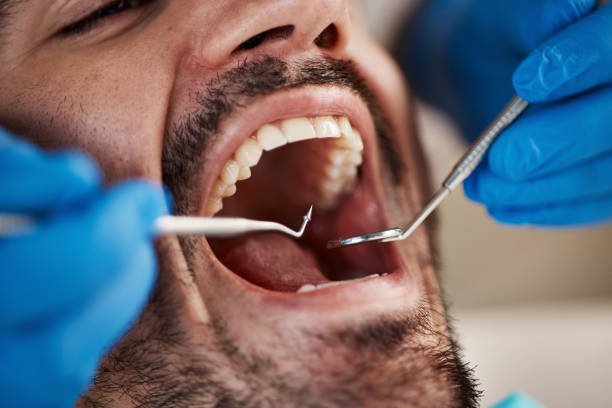 Best Broken or Cracked Tooth Emergency Dentist in Crosspointe, VA