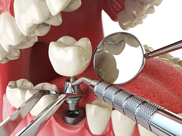 Best Broken or Cracked Tooth Emergency Dentist in Crosspointe, VA