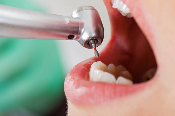 Best Pediatric Emergency Dentist in Crosspointe, VA